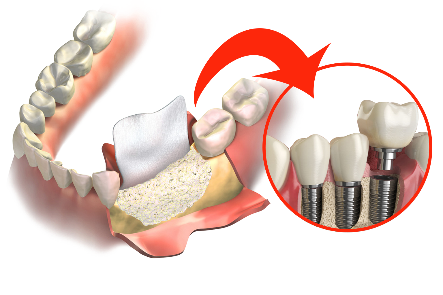 NovodentCR-Cirugía-Oral