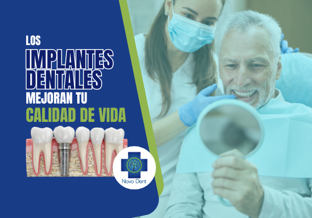 Los implantes dentales mejoran tu calidad de vida