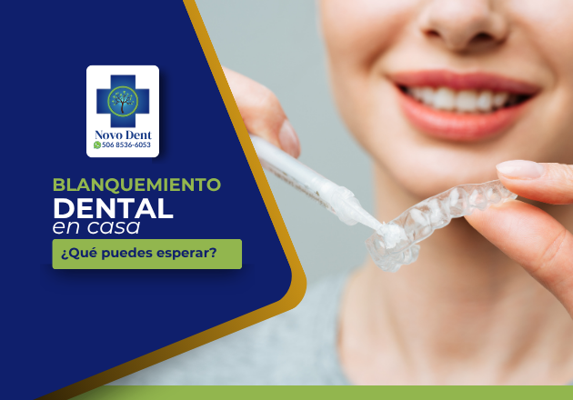 Blanqueamiento dental en casa con fundas